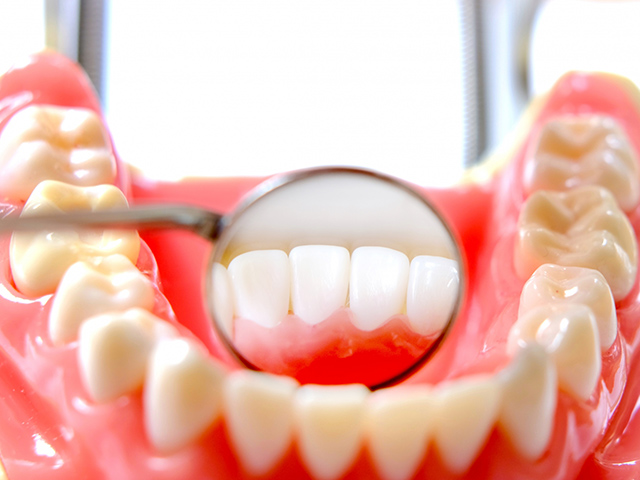 歯の模型で治療イメージを再現